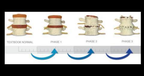 Spine phases