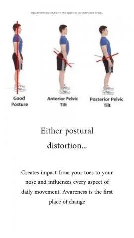postural distortion