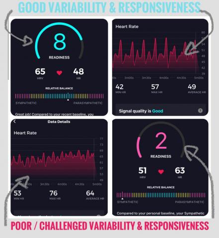 HRV